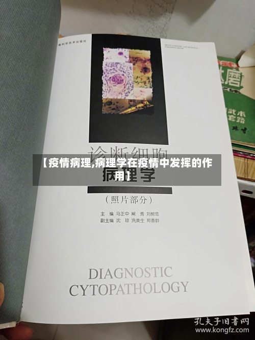 【疫情病理,病理学在疫情中发挥的作用】-第2张图片